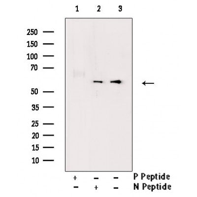 AF3469 staining HepG2 by IF/ICC. The sample were fixed with PFA and permeabilized in 0.1% Triton X-100,then blocked in 10% serum for 45 minutes at 25¡ãC. The primary antibody was diluted at 1/200 and incubated with the sample for 1 hour at 37¡ãC. An  Alexa Fluor 594 conjugated goat anti-rabbit IgG (H+L) Ab, diluted at 1/600, was used as the secondary antibod