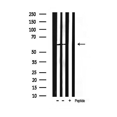 Western blot analysis of extracts from rat spleen, using Phospho-HDAC2 (Ser394) Antibody.