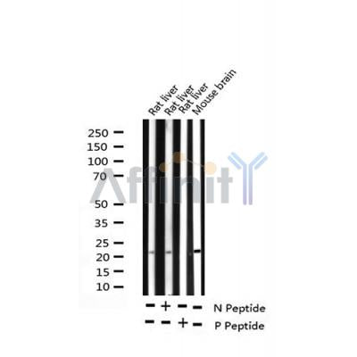 AF3471 staining 293 cells by IF/ICC. The sample were fixed with PFA and permeabilized in 0.1% Triton X-100,then blocked in 10% serum for 45 minutes at 25¡ãC. The primary antibody was diluted at 1/200 and incubated with the sample for 1 hour at 37¡ãC. An  Alexa Fluor 594 conjugated goat anti-rabbit IgG (H+L) antibody(Cat.