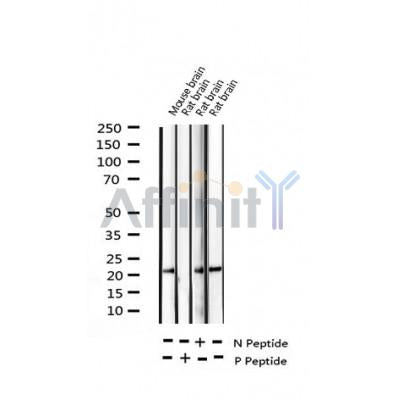 AF3473 staining HT29 by IF/ICC. The sample were fixed with PFA and permeabilized in 0.1% Triton X-100,then blocked in 10% serum for 45 minutes at 25¡ãC. The primary antibody was diluted at 1/200 and incubated with the sample for 1 hour at 37¡ãC. An  Alexa Fluor 594 conjugated goat anti-rabbit IgG (H+L) Ab, diluted at 1/600, was used as the secondary antibod
