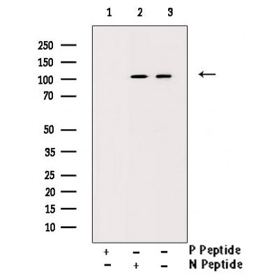 Western blot analysis of Phospho-SirT1 (Ser47) Antibody expression in JK cells lysates.The lane on the right is treated with the antigen-specific peptide.