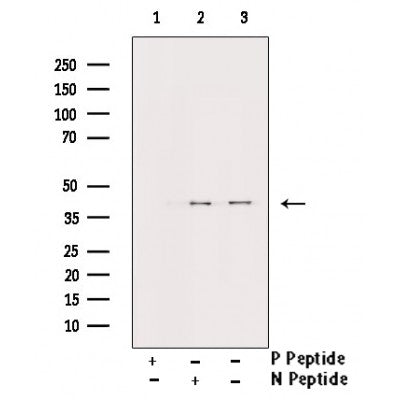 AF3475 staining COS7 by IF/ICC. The sample were fixed with PFA and permeabilized in 0.1% Triton X-100,then blocked in 10% serum for 45 minutes at 25¡ãC. The primary antibody was diluted at 1/200 and incubated with the sample for 1 hour at 37¡ãC. An  Alexa Fluor 594 conjugated goat anti-rabbit IgG (H+L) Ab, diluted at 1/600, was used as the secondary antibod