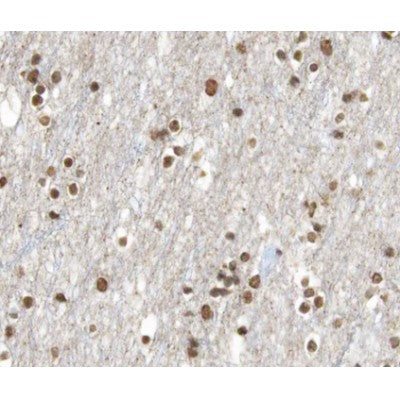 AF0249 at 1/100 staining human brain tissue sections by IHC-P. The tissue was formaldehyde fixed and a heat mediated antigen retrieval step in citrate buffer was performed. The tissue was then blocked and incubated with the antibody for 1.5 hours at 22¡ãC. An HRP conjugated goat anti-rabbit antibody was used as the secondary