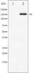 AF3476 staining MDA-MB-435 by IF/ICC. The sample were fixed with PFA and permeabilized in 0.1% Triton X-100,then blocked in 10% serum for 45 minutes at 25¡ãC. The primary antibody was diluted at 1/200 and incubated with the sample for 1 hour at 37¡ãC. An  Alexa Fluor 594 conjugated goat anti-rabbit IgG (H+L) Ab, diluted at 1/600, was used as the secondary antibod
