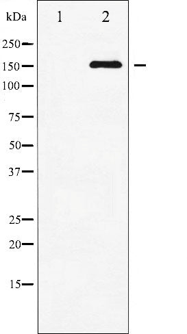 AF3476 staining MDA-MB-435 by IF/ICC. The sample were fixed with PFA and permeabilized in 0.1% Triton X-100,then blocked in 10% serum for 45 minutes at 25¡ãC. The primary antibody was diluted at 1/200 and incubated with the sample for 1 hour at 37¡ãC. An  Alexa Fluor 594 conjugated goat anti-rabbit IgG (H+L) Ab, diluted at 1/600, was used as the secondary antibod
