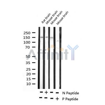 AF3477 staining MDA-MB-435 by IF/ICC. The sample were fixed with PFA and permeabilized in 0.1% Triton X-100,then blocked in 10% serum for 45 minutes at 25¡ãC. The primary antibody was diluted at 1/200 and incubated with the sample for 1 hour at 37¡ãC. An  Alexa Fluor 594 conjugated goat anti-rabbit IgG (H+L) Ab, diluted at 1/600, was used as the secondary antibod