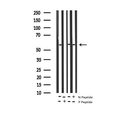 AF3478 staining Hela by IF/ICC. The sample were fixed with PFA and permeabilized in 0.1% Triton X-100,then blocked in 10% serum for 45 minutes at 25¡ãC. The primary antibody was diluted at 1/200 and incubated with the sample for 1 hour at 37¡ãC. An  Alexa Fluor 594 conjugated goat anti-rabbit IgG (H+L) Ab, diluted at 1/600, was used as the secondary antibod