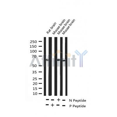 AF3479 staining Hela by IF/ICC. The sample were fixed with PFA and permeabilized in 0.1% Triton X-100,then blocked in 10% serum for 45 minutes at 25¡ãC. The primary antibody was diluted at 1/200 and incubated with the sample for 1 hour at 37¡ãC. An  Alexa Fluor 594 conjugated goat anti-rabbit IgG (H+L) Ab, diluted at 1/600, was used as the secondary antibod