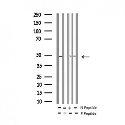 AF3481 staining Hela by IF/ICC. The sample were fixed with PFA and permeabilized in 0.1% Triton X-100,then blocked in 10% serum for 45 minutes at 25¡ãC. The primary antibody was diluted at 1/200 and incubated with the sample for 1 hour at 37¡ãC. An  Alexa Fluor 594 conjugated goat anti-rabbit IgG (H+L) Ab, diluted at 1/600, was used as the secondary antibod