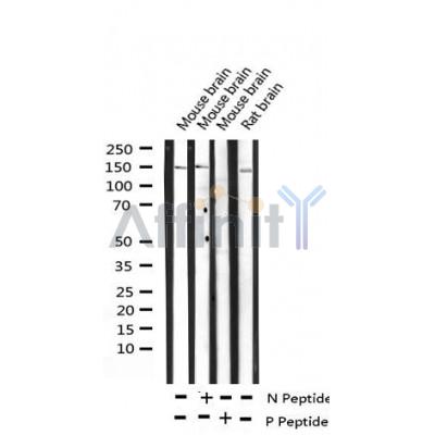 AF3484 at 1/100 staining Human lung tissue by IHC-P. The sample was formaldehyde fixed and a heat mediated antigen retrieval step in citrate buffer was performed. The sample was then blocked and incubated with the antibody for 1.5 hours at 22¡ãC. An HRP conjugated goat anti-rabbit antibody was used as the secondary