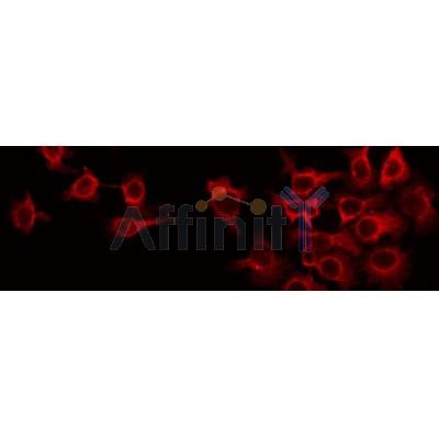 AF0250 staining Hela by IF/ICC. The sample were fixed with PFA and permeabilized in 0.1% Triton X-100,then blocked in 10% serum for 45 minutes at 25¡ãC. The primary antibody was diluted at 1/200 and incubated with the sample for 1 hour at 37¡ãC. An  Alexa Fluor 594 conjugated goat anti-rabbit IgG (H+L) Ab, diluted at 1/600, was used as the secondary antibod