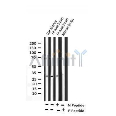 AF3488 staining Hela by IF/ICC. The sample were fixed with PFA and permeabilized in 0.1% Triton X-100,then blocked in 10% serum for 45 minutes at 25¡ãC. The primary antibody was diluted at 1/200 and incubated with the sample for 1 hour at 37¡ãC. An  Alexa Fluor 594 conjugated goat anti-rabbit IgG (H+L) Ab, diluted at 1/600, was used as the secondary antibod