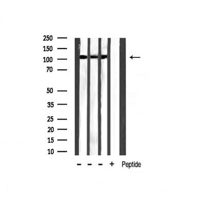 AF3490 staining Hela by IF/ICC. The sample were fixed with PFA and permeabilized in 0.1% Triton X-100,then blocked in 10% serum for 45 minutes at 25¡ãC. The primary antibody was diluted at 1/200 and incubated with the sample for 1 hour at 37¡ãC. An  Alexa Fluor 594 conjugated goat anti-rabbit IgG (H+L) Ab, diluted at 1/600, was used as the secondary antibod