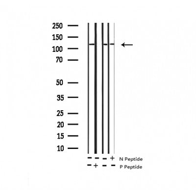 AF3491 staining Hela by IF/ICC. The sample were fixed with PFA and permeabilized in 0.1% Triton X-100,then blocked in 10% serum for 45 minutes at 25¡ãC. The primary antibody was diluted at 1/200 and incubated with the sample for 1 hour at 37¡ãC. An  Alexa Fluor 594 conjugated goat anti-rabbit IgG (H+L) Ab, diluted at 1/600, was used as the secondary antibod