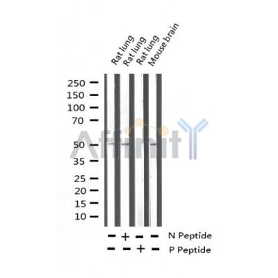 AF3493 staining NIH-3T3 by IF/ICC. The sample were fixed with PFA and permeabilized in 0.1% Triton X-100,then blocked in 10% serum for 45 minutes at 25¡ãC. The primary antibody was diluted at 1/200 and incubated with the sample for 1 hour at 37¡ãC. An  Alexa Fluor 594 conjugated goat anti-rabbit IgG (H+L) Ab, diluted at 1/600, was used as the secondary antibod