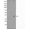 AF5010 staining MCF-7 cells by ICC/IF. Cells were fixed with PFA and permeabilized in 0.1% saponin prior to blocking in 10% serum for 45 minutes at 37¡ãC. The primary antibody was diluted 1/400 and incubated with the sample for 1 hour at 37¡ãC. A  Alexa Fluor? 594 conjugated goat polyclonal to rabbit IgG (H+L), diluted 1/600 was used as secondary antibod