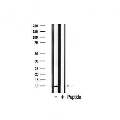 Western blot analysis on rat brain lysate using S100 A1 Antibody