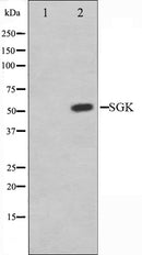 AF6001 at 1/100 staining Mouse liver tissue by IHC-P. The sample was formaldehyde fixed and a heat mediated antigen retrieval step in citrate buffer was performed. The sample was then blocked and incubated with the antibody for 1.5 hours at 22¡ãC. An HRP conjugated goat anti-rabbit antibody was used as the secondary