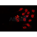 Western blot analysis of extracts from HepG2, using Chk1 Antibody. Lane 1 was treated with the blocking peptide.