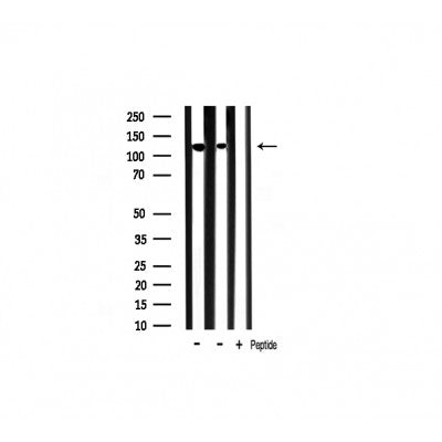 Western blot analysis of SHIP1 expression in various lysates