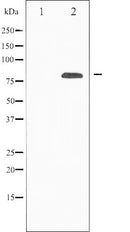 Western blot analysis of p73 expression in K562 whole cell lysates,The lane on the left is treated with the antigen-specific peptide.
