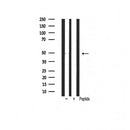 Western blot analysis of extracts from various samples, using HDAC3 Antibody.
 Lane 1: Hela treated with blocking peptide;
 Lane 2: Hela;
Lane 3: 293;
Lane 4: HepG2;
Lane 5: Mouse lung.
