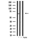 Western blot analysis of extracts from various samples, using PDK1 Antibody.
 Lane 1: 3T3 treated with blocking peptide;
 Lane 2: 3T3;
Lane 3: SP2/0.