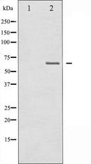 AF6019 at 1/100 staining Human liver cancer tissue by IHC-P. The sample was formaldehyde fixed and a heat mediated antigen retrieval step in citrate buffer was performed. The sample was then blocked and incubated with the antibody for 1.5 hours at 22¡ãC. An HRP conjugated goat anti-rabbit antibody was used as the secondary
