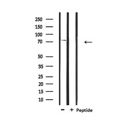 Western blot analysis of extracts from 293, using IL-2Rbeta/CD122 Antibody.The lane on the right is treated with the antigen-specific peptide.