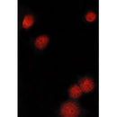 Western blot analysis of extracts from 293, using MITF Antibody. Lane 1 was treated with the blocking peptide.