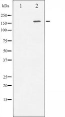 Western blot analysis of ROCK2 expression in COS7 whole cell lysates,The lane on the left is treated with the antigen-specific peptide.
