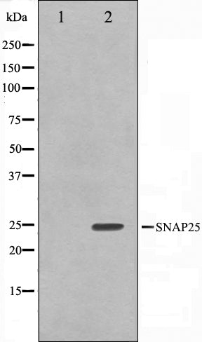 Western blot analysis on RAW264.7 cell lysate using SNAP25 Antibody,The lane on the left is treated with the antigen-specific peptide.