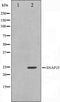 Western blot analysis on RAW264.7 cell lysate using SNAP25 Antibody,The lane on the left is treated with the antigen-specific peptide.