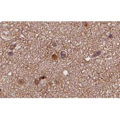 AF0254 at 1/100 staining human brain tissue sections by IHC-P. The tissue was formaldehyde fixed and a heat mediated antigen retrieval step in citrate buffer was performed. The tissue was then blocked and incubated with the antibody for 1.5 hours at 22¡ãC. An HRP conjugated goat anti-rabbit antibody was used as the secondary