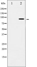 AF6031 at 1/100 staining Human lung tissue by IHC-P. The sample was formaldehyde fixed and a heat mediated antigen retrieval step in citrate buffer was performed. The sample was then blocked and incubated with the antibody for 1.5 hours at 22¡ãC. An HRP conjugated goat anti-rabbit antibody was used as the secondary
