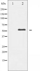 AF6037 at 1/100 staining Human gastric tissue by IHC-P. The sample was formaldehyde fixed and a heat mediated antigen retrieval step in citrate buffer was performed. The sample was then blocked and incubated with the antibody for 1.5 hours at 22¡ãC. An HRP conjugated goat anti-rabbit antibody was used as the secondary