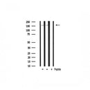 Western blot analysis of extracts from Myeloma cells, using EGFR Antibody. Lane 1 was treated with the blocking peptide.