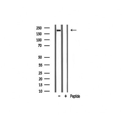 Western blot analysis on rat muscle tissue lysate using Sodium Channel-pan Antibody