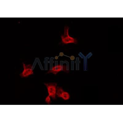 AF0255 staining HuvEc by IF/ICC. The sample were fixed with PFA and permeabilized in 0.1% Triton X-100,then blocked in 10% serum for 45 minutes at 25¡ãC. The primary antibody was diluted at 1/200 and incubated with the sample for 1 hour at 37¡ãC. An  Alexa Fluor 594 conjugated goat anti-rabbit IgG (H+L) Ab, diluted at 1/600, was used as the secondary antibod