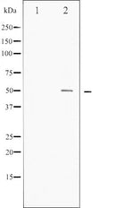 AF6054 at 1/100 staining Human breast cancer tissue by IHC-P. The sample was formaldehyde fixed and a heat mediated antigen retrieval step in citrate buffer was performed. The sample was then blocked and incubated with the antibody for 1.5 hours at 22¡ãC. An HRP conjugated goat anti-rabbit antibody was used as the secondary