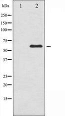 AF6055 at 1/100 staining Human breast cancer tissue by IHC-P. The sample was formaldehyde fixed and a heat mediated antigen retrieval step in citrate buffer was performed. The sample was then blocked and incubated with the antibody for 1.5 hours at 22¡ãC. An HRP conjugated goat anti-rabbit antibody was used as the secondary