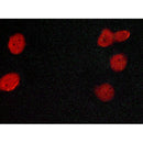 Western blot analysis of extracts from HepG2, using Estrogen Receptor-alpha Antibody. Lane 1 was treated with the blocking peptide.