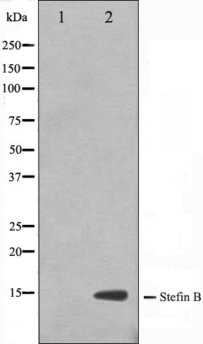 Western blot analysis on A549 cell lysate using CSTB Antibody,The lane on the left is treated with the antigen-specific peptide.