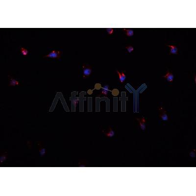 AF0256 staining A549 cells by IF/ICC. The sample were fixed with PFA and permeabilized in 0.1% Triton X-100,then blocked in 10% serum for 45 minutes at 25¡ãC. The primary antibody was diluted at 1/200 and incubated with the sample for 1 hour at 37¡ãC. An  Alexa Fluor 594 conjugated goat anti-rabbit IgG (H+L) antibody(Cat.