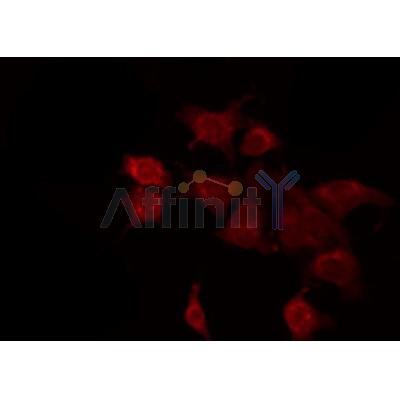 AF0256 staining A549 by IF/ICC. The sample were fixed with PFA and permeabilized in 0.1% Triton X-100,then blocked in 10% serum for 45 minutes at 25¡ãC. The primary antibody was diluted at 1/200 and incubated with the sample for 1 hour at 37¡ãC. An  Alexa Fluor 594 conjugated goat anti-rabbit IgG (H+L) Ab, diluted at 1/600, was used as the secondary antibod