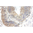 Western blot analysis of extracts from various samples, using Keratin 8 Antibody.
 Lane 1: Hela treated with blocking peptide;
 Lane 2: Hela;
Lane 3: 293;
Lane 4: HepG2;
Lane 5: Mouse lung.