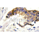 AF6098 staining MCF-7 cells by ICC/IF. Cells were fixed with PFA and permeabilized in 0.1% saponin prior to blocking in 10% serum for 45 minutes at 37¡ãC. The primary antibody was diluted 1/400 and incubated with the sample for 1 hour at 37¡ãC. A  Alexa Fluor? 594 conjugated goat polyclonal to rabbit IgG (H+L), diluted 1/600 was used as secondary antibod