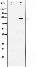 Western blot analysis of IR expression in COS7 whole cell lysates,The lane on the left is treated with the antigen-specific peptide.