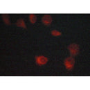 Western blot analysis of extracts from HepG2, using Lck Antibody. Lane 1 was treated with the blocking peptide.