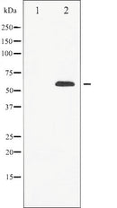 AF6101 staining Hela by IF/ICC. The sample were fixed with PFA and permeabilized in 0.1% Triton X-100,then blocked in 10% serum for 45 minutes at 25¡ãC. The primary antibody was diluted at 1/200 and incubated with the sample for 1 hour at 37¡ãC. An  Alexa Fluor 594 conjugated goat anti-rabbit IgG (H+L) Ab, diluted at 1/600, was used as the secondary antibod